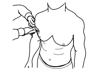 Skinfold Measurement Chart